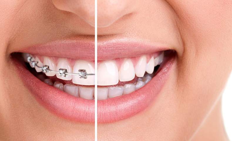 orthodontics
